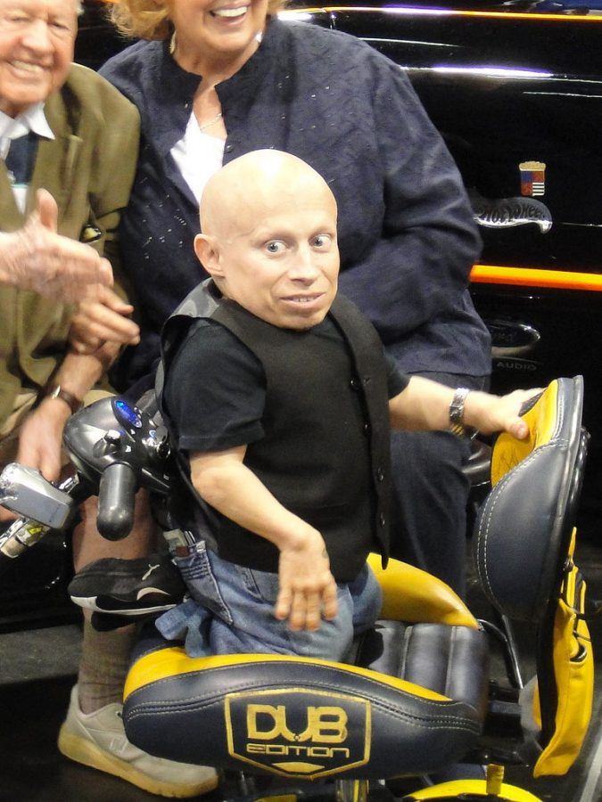 Verne+Troyer+Dies+at+49