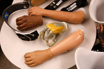 Advancements of Prosthetic Limbs