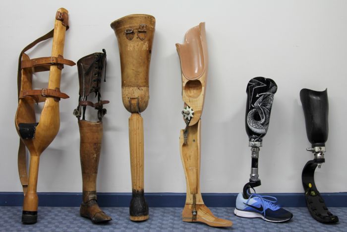 Advancements of Prosthetic Limbs