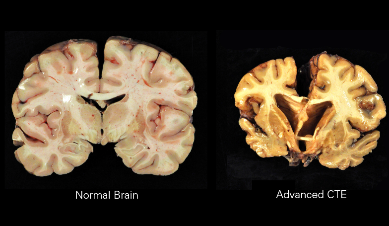 The+Impact+of+CTE